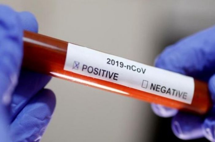 Что делать при отказе проводить тест на коронавирус: ответ Минздрава