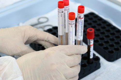 Минздрав ждет завершения испытаний "антигенных" тестов на "ковид"