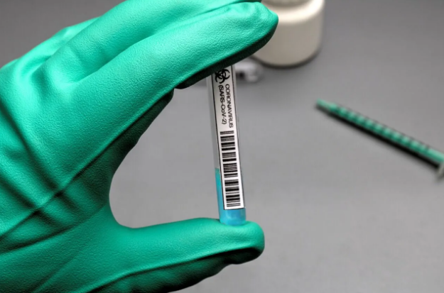 Бесплатный тест на коронавирус: как сделать и куда обращаться
