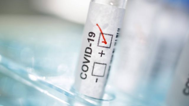 Фармкомпания "Фармак" совместно с украинскими учеными создали ПЦР-тест, выявляющий новые штаммы коронавируса