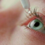 Синдром сухого глаза: причины, симптомы и методы лечения