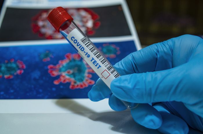 Треть украинцев имеют антитела к коронавирусу - исследование