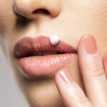 Лікар пояснила, чому насправді на губах утворюється “лихоманка”