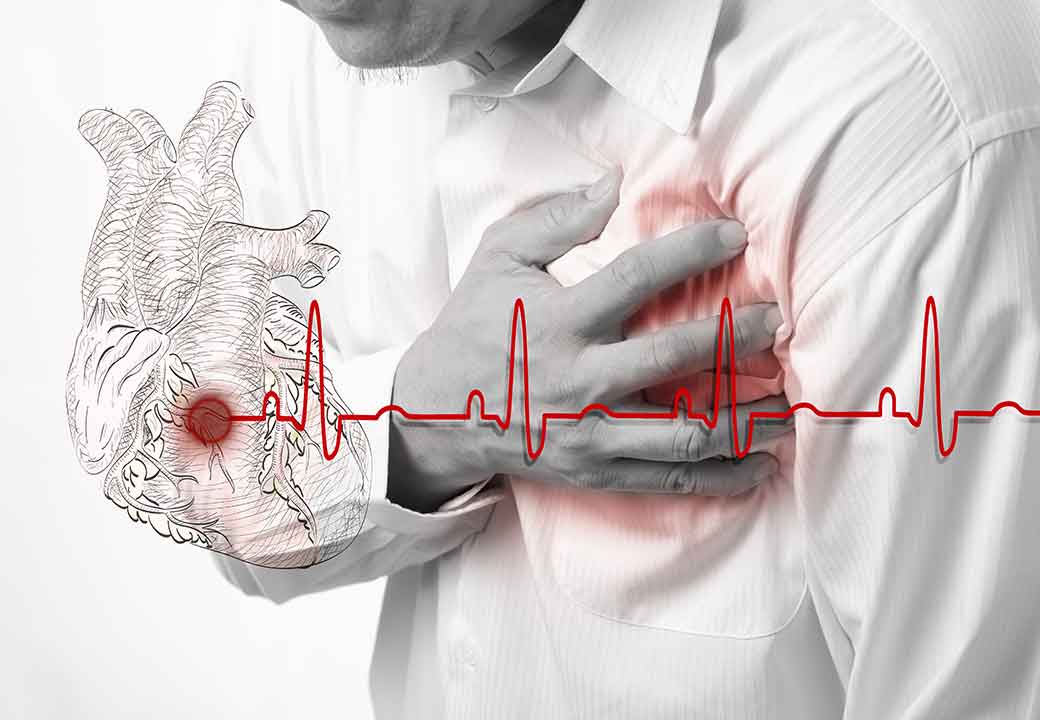 Кардиологи рассказали о скрытых признаках инфаркта