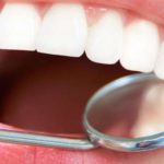Пять реальных способов сохранить зубы здоровыми