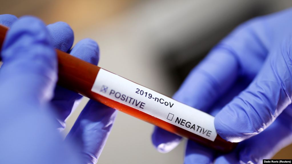 Минздрав: в Украине не зарегистрировано ни одного случая нового коронавируса