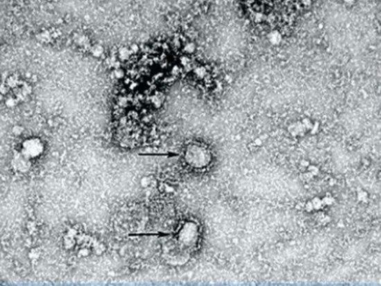 Китайские ученные впервые сумели сфотографировать смертельный вирус (ФОТО)