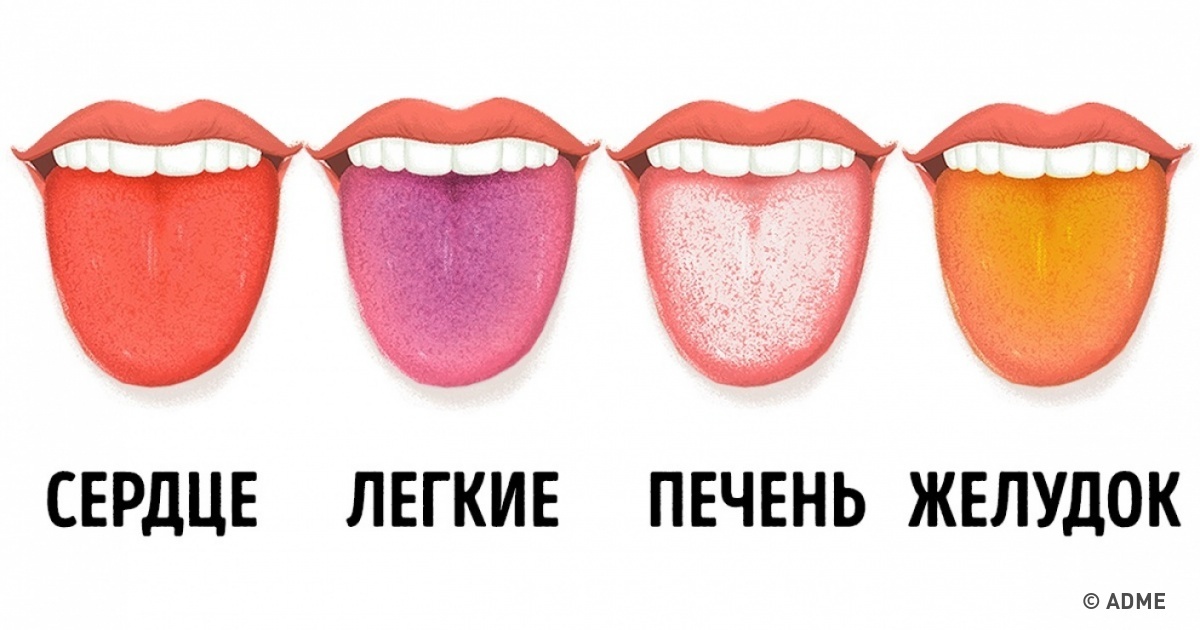 Как определить болезнь по цвету языка