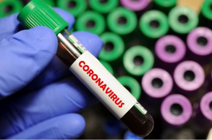 В Минздраве заявили, что тест на коронавирус можно купить в аптеках