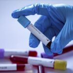 МОЗ Украины планирует тестировать на антитела к коронавируса: что известно про ИФА-тесты