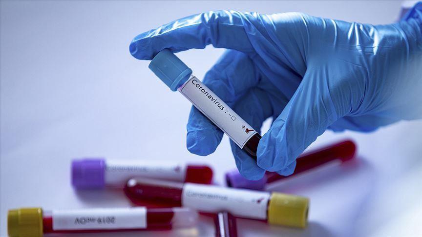 МОЗ Украины планирует тестировать на антитела к коронавируса: что известно про ИФА-тесты