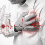 Первые симптомы, которые говорят о скором инфаркте