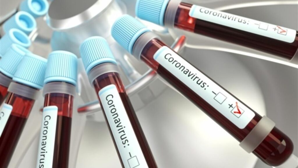 Тест на коронавирус: ставка на ПЦР-метод