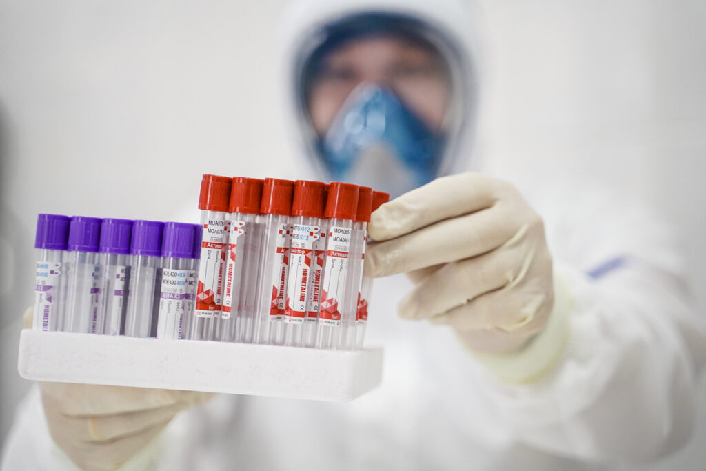 В Украине ввели тестирование на антитела к коронавируса: кого тестировать