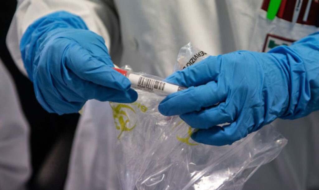 За сутки в Украине обнаружили 328 новых случаев коронавируса