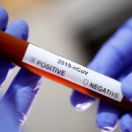 Новый всплеск коронавируса в Украине: за сутки выявлено 587 новых случаев заражения