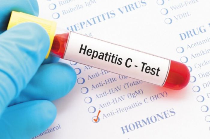 В Украине лишь 6,5% больных гепатитом С знают о своем диагнозе