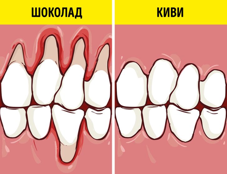 Врачи назвали продукты, которые сохранят здоровыми десна и зубы