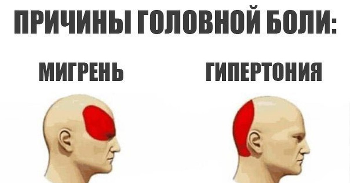 Головные боли картинки с надписями