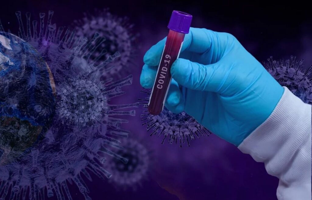 В мире уже более 33,5 млн человек заболели на коронавирус