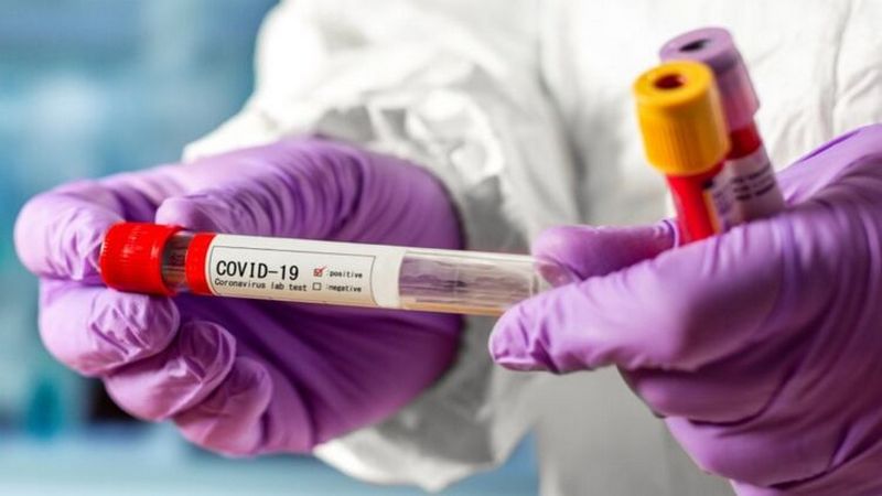 Стало известно, какие симптомы коронавируса самые распространенные в Украине
