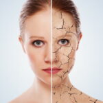 Какие продукты способны эффективно справиться с заболеваниями кожи