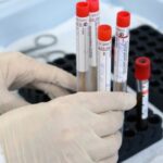 Минздрав ждет завершения испытаний “антигенных” тестов на “ковид”