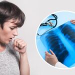 Как распознать симптомы замаскированной пневмонии