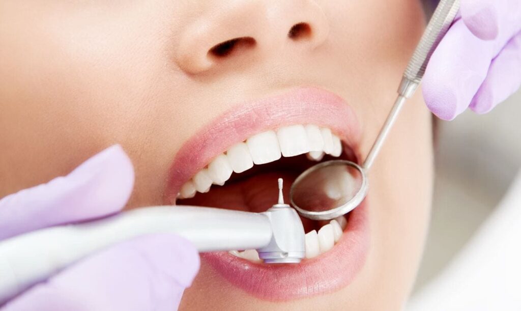 Распространенные болезни зубов и способы их лечения