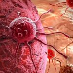 Медики празднуют победу: “убита” распространенная мутация рака