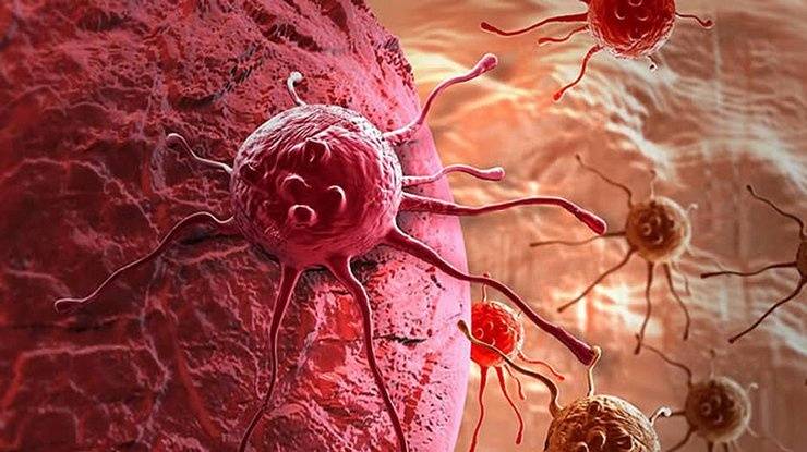 Медики празднуют победу: "убита" распространенная мутация рака