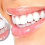 Как отбелить зубы без вреда для здоровья: народные способы
