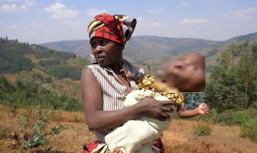 В Руанде женщина родила ребенка с головой в форме груши (ФОТО)