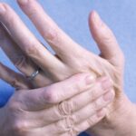 Почему горят пальцы рук: жжение в пальцах рук