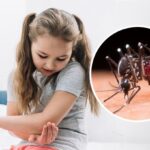 Як доглядати за раною після укусу комара, щоб вона швидше загоїлась: поради педіатра