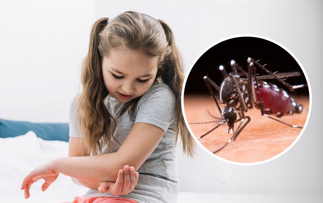 Як доглядати за раною після укусу комара, щоб вона швидше загоїлась: поради педіатра