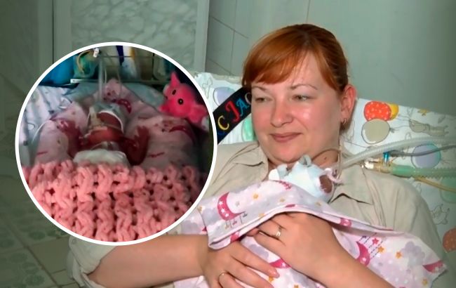 "Унікальний випадок": у Тернополі врятували крихітку дівчинку з вагою 560 грамів